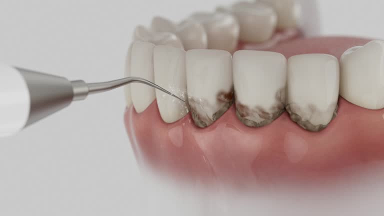 Trusted Teeth Cleaning And Checkup service in Statesville, NC - Dentist Open Now